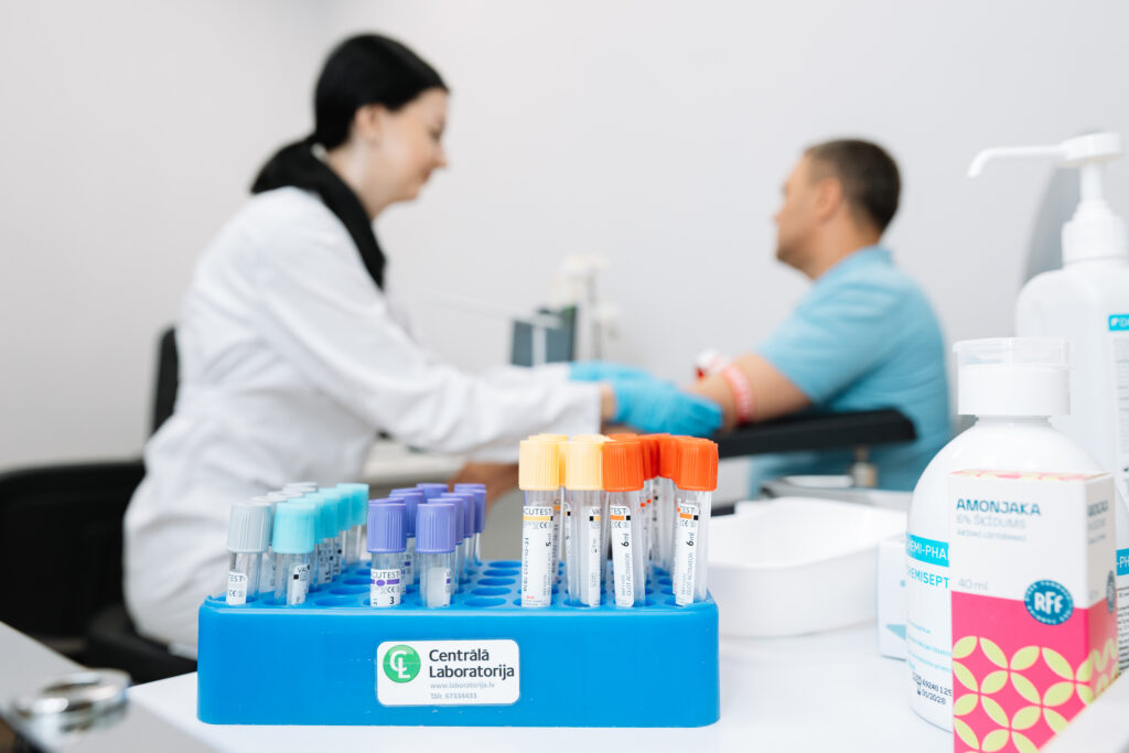 Sociāla kampaņa - bezmaksas  C hepatīta antivielu tests visās "Centrālās laboratorijas" filiālēs