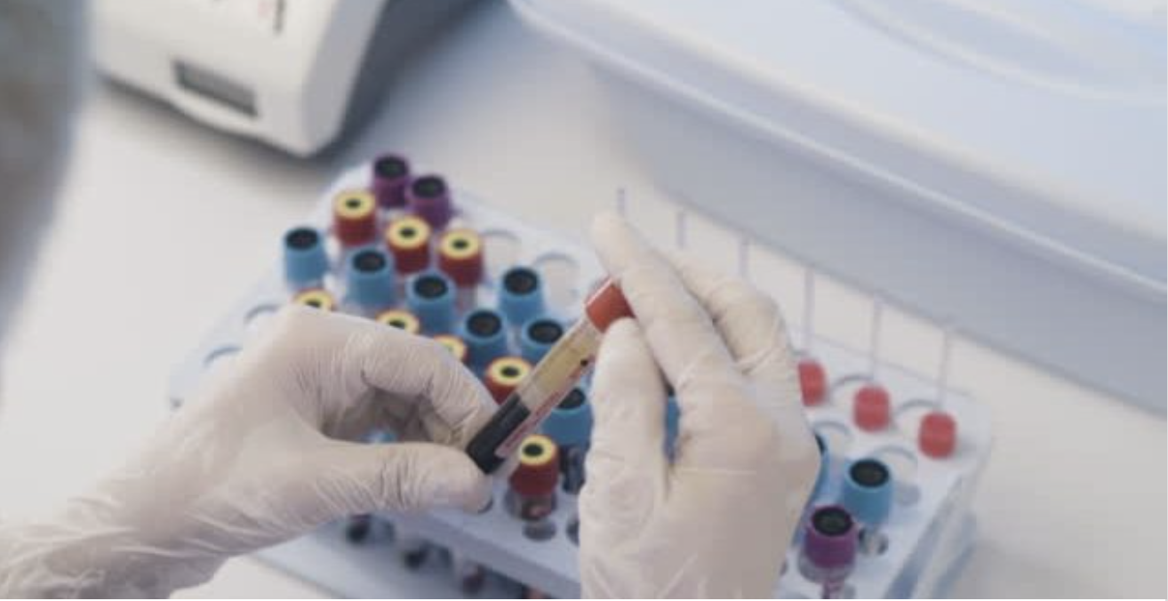 “Centrālās laboratorijas” peļņa pērn augusi 2,1 reizi - Medikamentu Informācijas Centrs